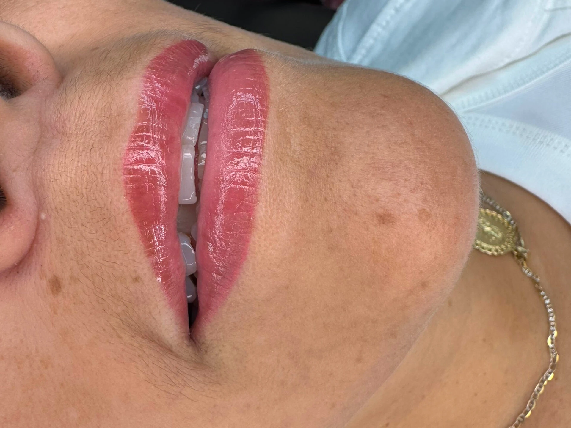 lip-blush-coloring-west-hartford-ct-color-enhancement-results-landscape-1